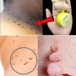 One Tablespoon in the Morning: A Natural Remedy for Frequent Constipation