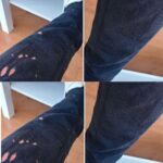 Do You Want to Know How to Remove Corns Naturally? Here’s What Actually Works (Backed by Facts & Studies)