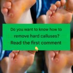Best Method Against Fleas Using Garlic: A Natural and Powerful Remedy