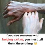 Consequences of Kissing a Deceased Person: What You Should Know