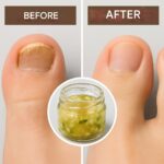 🌿 “Natural Morphine”: The Incredible Pain-Relieving Power of Rosemary