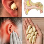 🧄 How to Use Garlic to Get Rid of Pests: Mice, Flies, Lice, Cockroaches, Lizards, Mosquitoes, and Kitchen Cockroaches