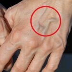 Euphorbia Hirta (Asthma-Plant): Powerful Benefits for the Lungs and Respiratory System