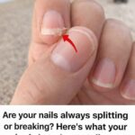 Hip pain: what does it mean? Causes, warnings, and when you should worry